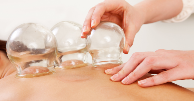 The Benefits of TCM Cupping Therapy in Singapore: A Holistic Approach to Wellness